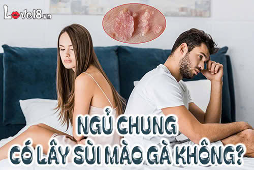 Ngủ chung có lây sùi mào gà không