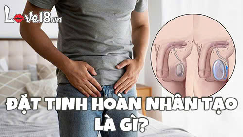Đặt tinh hoàn nhân tạo là gì? Có an toàn không? 1 Đặt tinh hoàn nhân tạo là gì