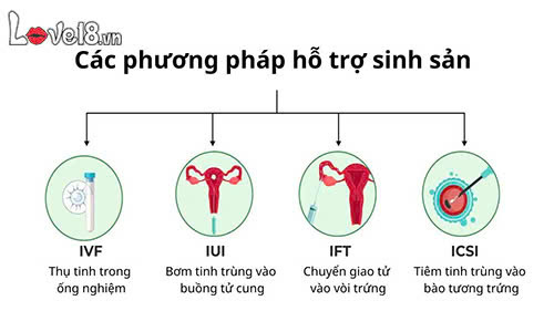 Vô sinh là gì? Hiểu rõ để bảo vệ khả năng sinh sản 7 cách khắc phục vô sinh là gì