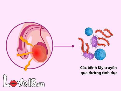 Quan hệ ngày đèn đỏ có bị vô sinh không? Nguy cơ cần biết 4 quan hệ ngày đèn đỏ có bị vô sinh không? rủi ro là gì?