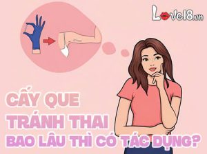 Cấy que tránh thai bao lâu thì có tác dụng?