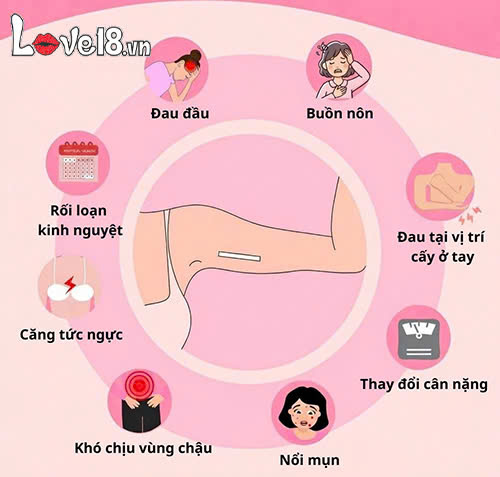 Cấy que tránh thai bao lâu thì có tác dụng? Bác sĩ giải đáp 5 Sau khi cấy que tránh thai bao lâu thì có tác dụng?