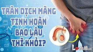 tràn dịch màng tinh hoàn bao lâu thì khỏi