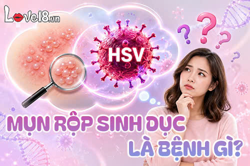 Mụn rộp sinh dục là bệnh gì