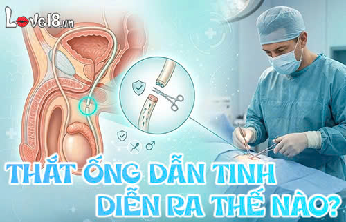 thắt ống dẫn tinh diễn ra thế nào