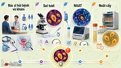 Trichomoniasis là bệnh gì? Dấu hiệu, đường lây và cách trị 6 trichomoniasis là bệnh gì và cách chẩn đoán bệnh
