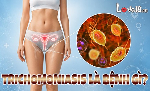 Trichomoniasis là bệnh gì? Dấu hiệu, đường lây và cách trị 1 trichomoniasis là bệnh gì