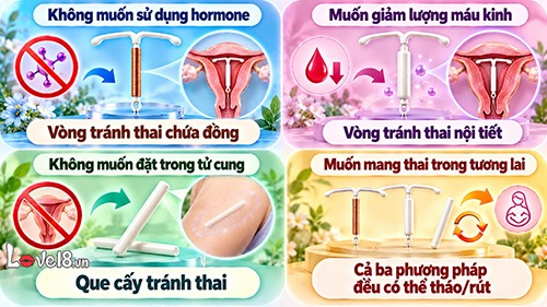 Nên đặt vòng hay cấy que tránh thai? So sánh chi tiết 3 loại 3 nên đặt vòng hay cấy que tránh thai? Cách chọn theo nhu cầu