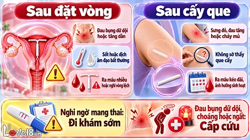 Nên đặt vòng hay cấy que tránh thai? So sánh chi tiết 3 loại 4 nên đặt vòng hay cấy que tránh thai và dấu hiệu thăm khám